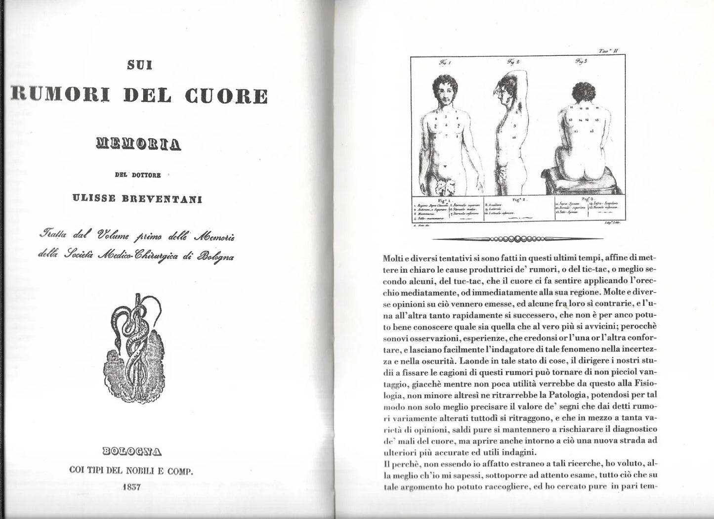 ULISSE BREVENTANI SUI RUMORI DEL CUORE 1837 TORCHIO DE' RICCI ANASTATICA