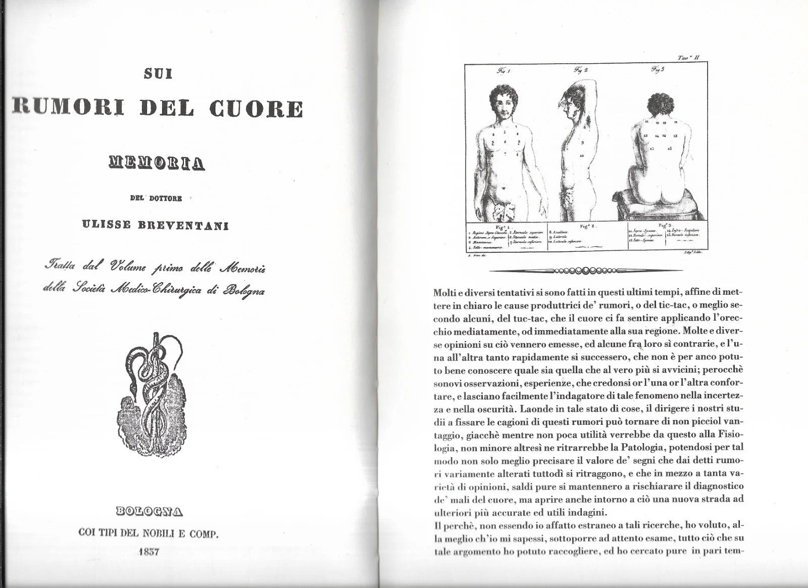 ULISSE BREVENTANI SUI RUMORI DEL CUORE 1837 TORCHIO DE' RICCI ANASTATICA