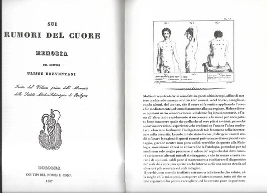 ULISSE BREVENTANI SUI RUMORI DEL CUORE 1837 TORCHIO DE' RICCI ANASTATICA