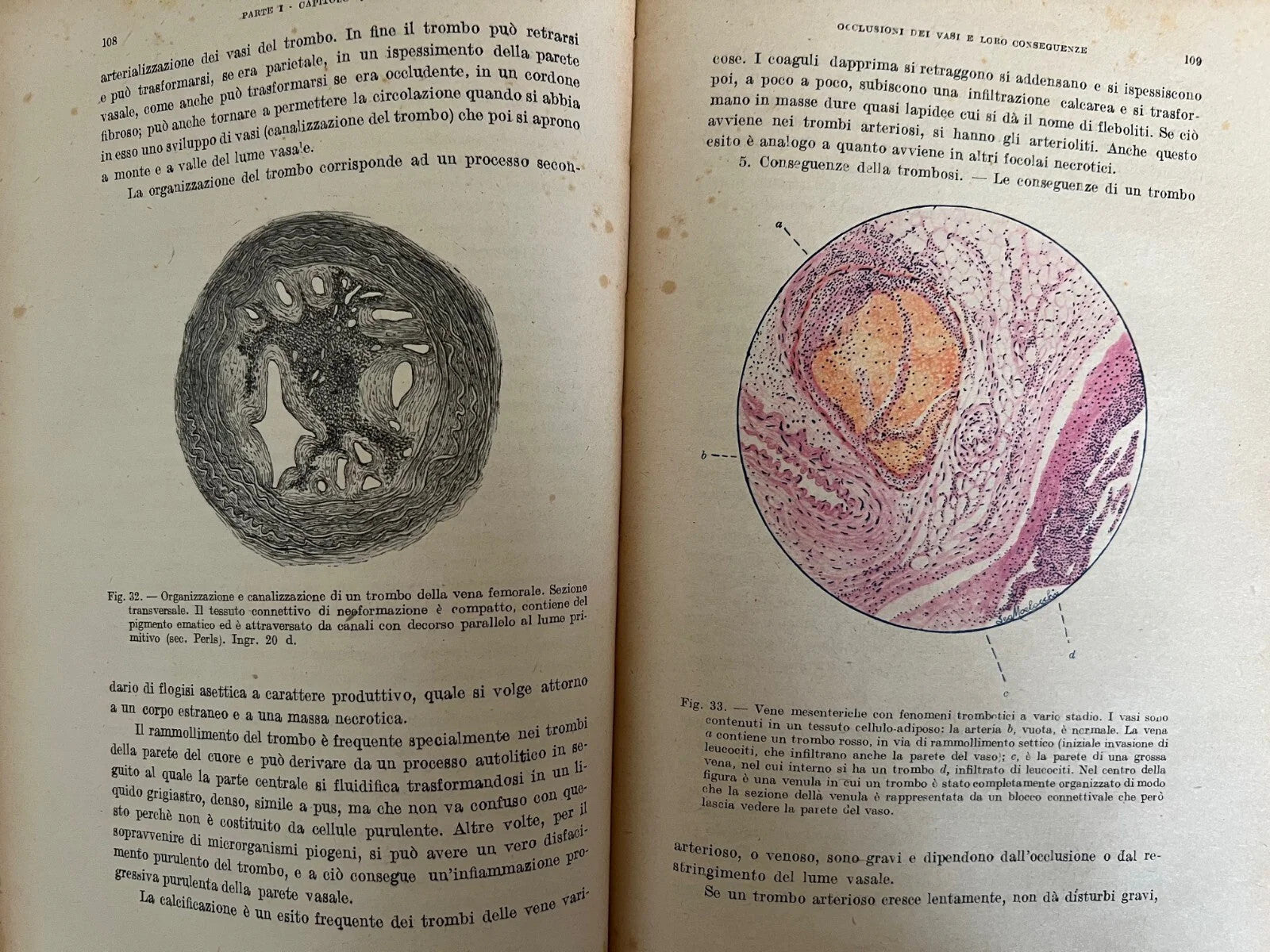 TRATTATO DI PATOLOGIA GENERALE VOL. II GUERRINI - GALEOTTI 1947 SOC. EDITRICE LI